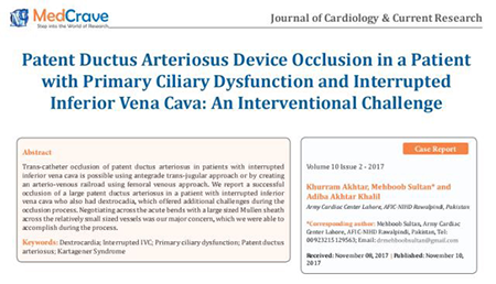 Memopart™PDA Occluser resgatou com sucesso crianças com coração congênito complexo no Paquistão