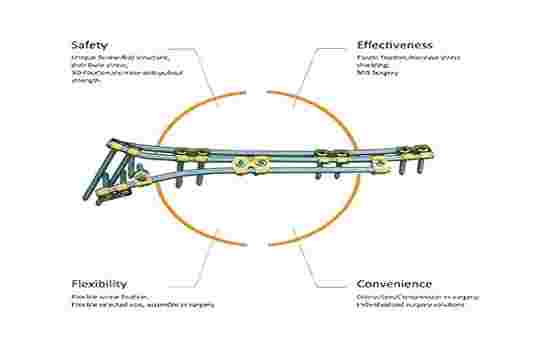 Status atual e tendência de desenvolvimento futuro do mercado global Staplers