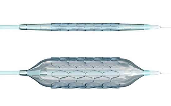 Qual é a diferença entre um Stent e um Cateter Balão?