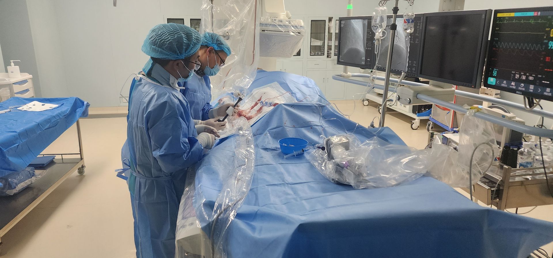 Case Sharing | Balão Vesscrack Coronário IVL para Tratamento Grave Lesão Calcificada