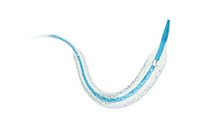 Cinco mal-entendidos da doença cardíaca coronária Stening