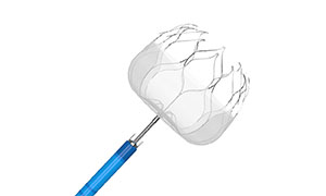 Conhecimento sobre oclusão do apêndice atrial esquerdo