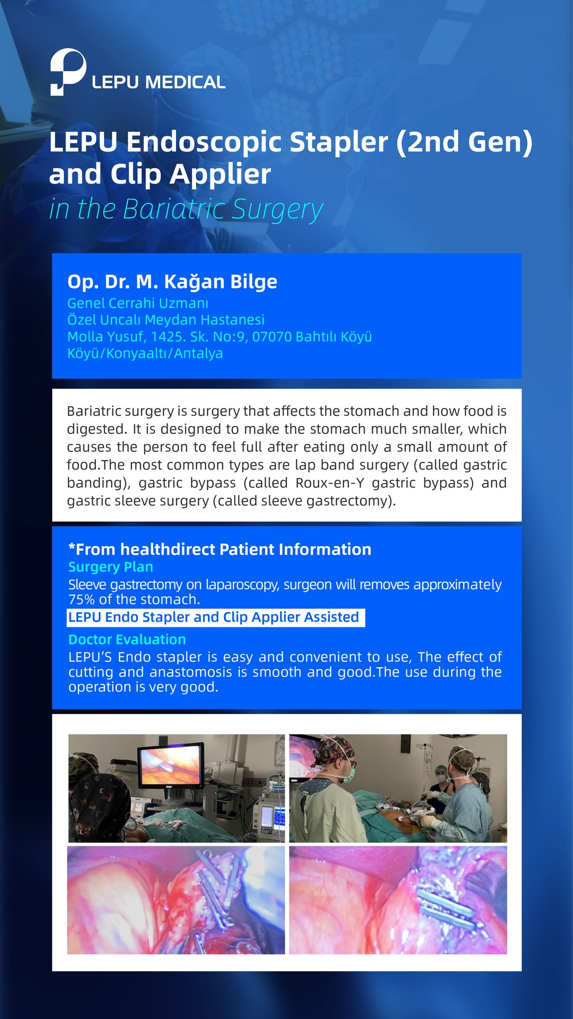 Cirurgia bariátrica com LEPU 2nd Gen Endoscopic Grampeador & Clip Applier!