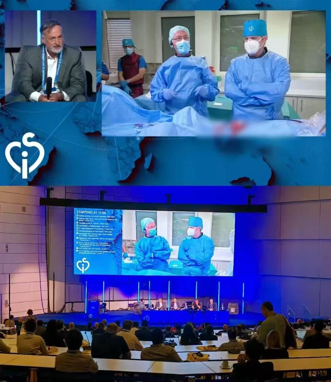 Live from CSI Frankfurt | Primeiro Ocluder PFO Absorvível do Mundo em Ação