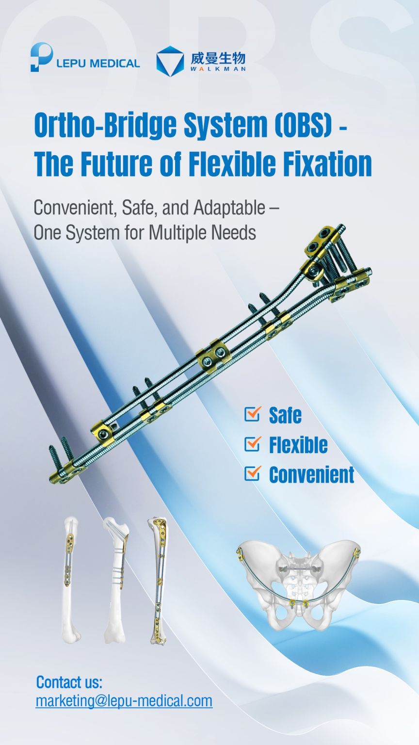 Case Sharing | Fratura do úmero diafisário médio a distal do terceiro