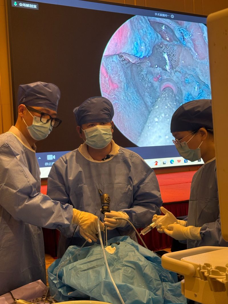 Revolucionando a cirurgia base nasal e do crânio: o sinuscópio asférico 4K da Shenda vence o louvor do especialista