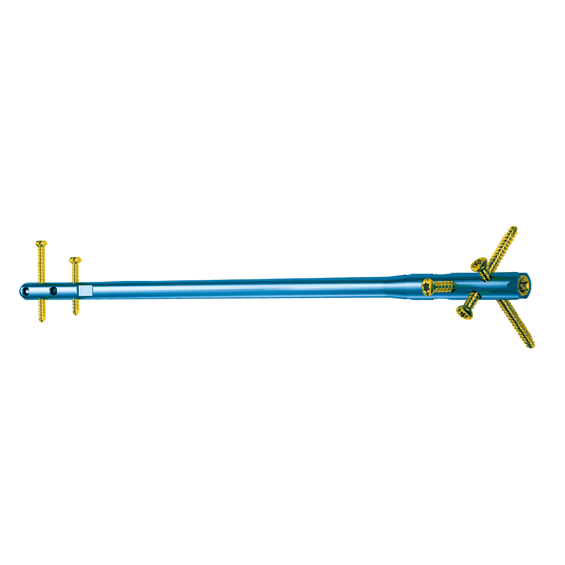 Bloqueio intramedular sistema unhas