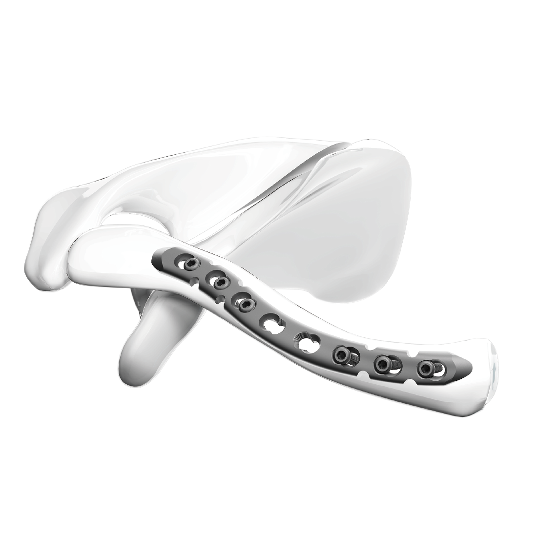 Superior-Anterior-Clavícula-Bloqueio-Placa de Compressão