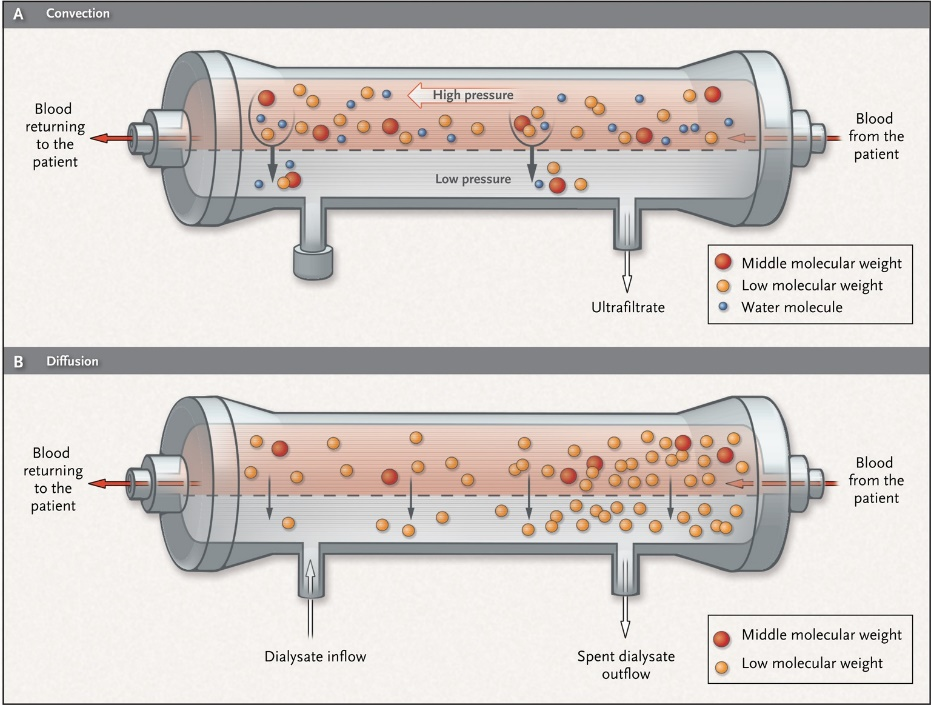 hemodialysis-vs-Hemofiltration2.png hemodialysis-vs-Hemofiltration2.png