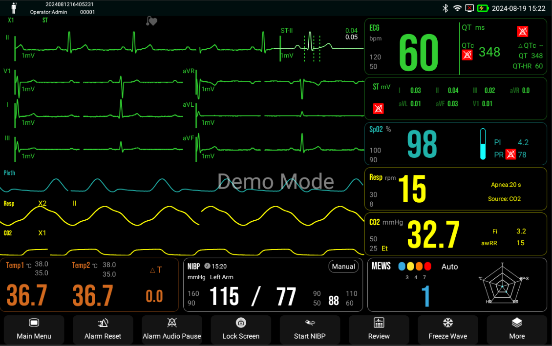 datatypefor datafanyifanyiAnlise HRV Anlise ST e QT