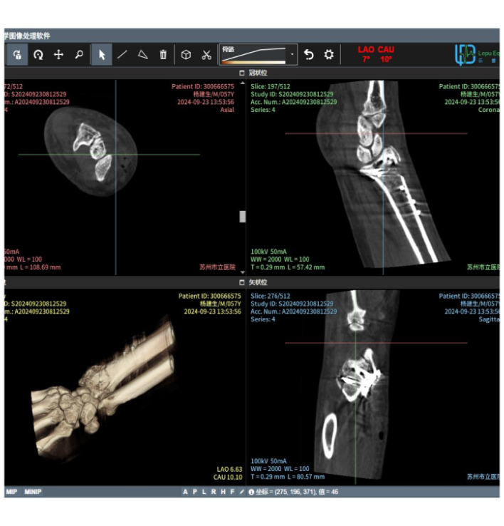 Caractersticas do produto 1. Controle de baixa dose