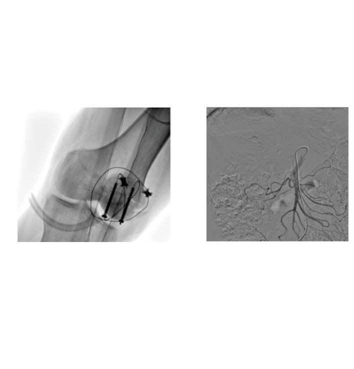 3. Abrangente Cobertura de Cenrios Cirrgicos e Interv